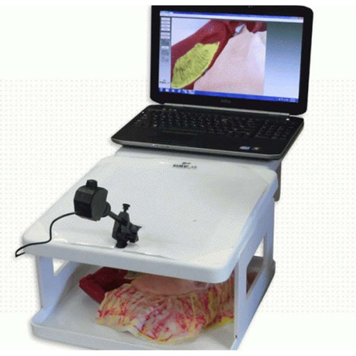 Image 2 - LAPAROSCOPIC CHOLECYSTENTEROSTOMY MODEL