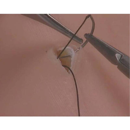 Image 2 - SUBCUTICULAR SUTURING MODEL