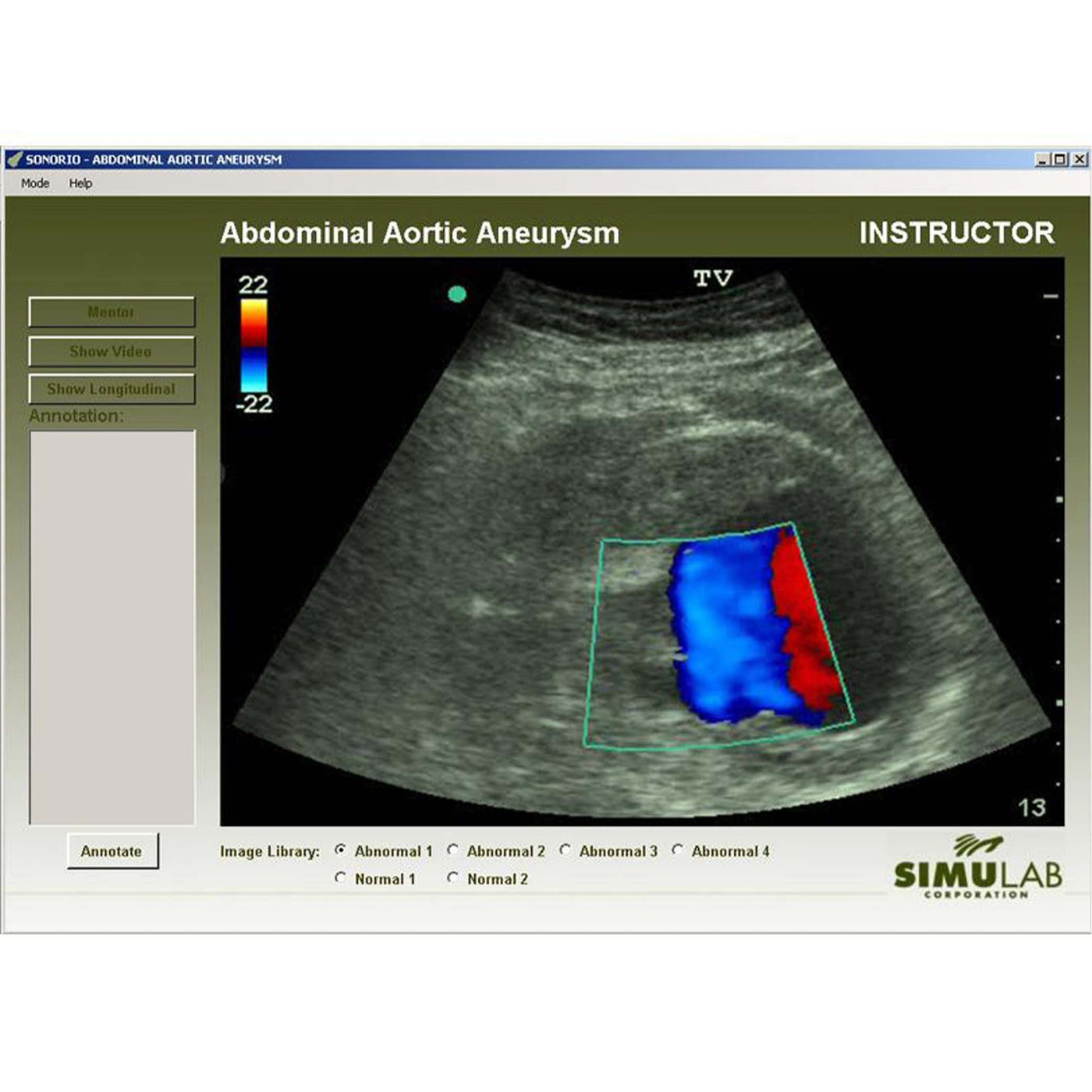 AAA Module for SonoMan System Diagnostic Ultrasound Trainer — Health ...