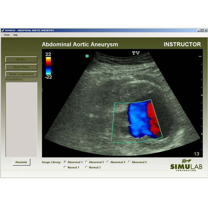AAA Module for SonoMan System Diagnostic Ultrasound Trainer
