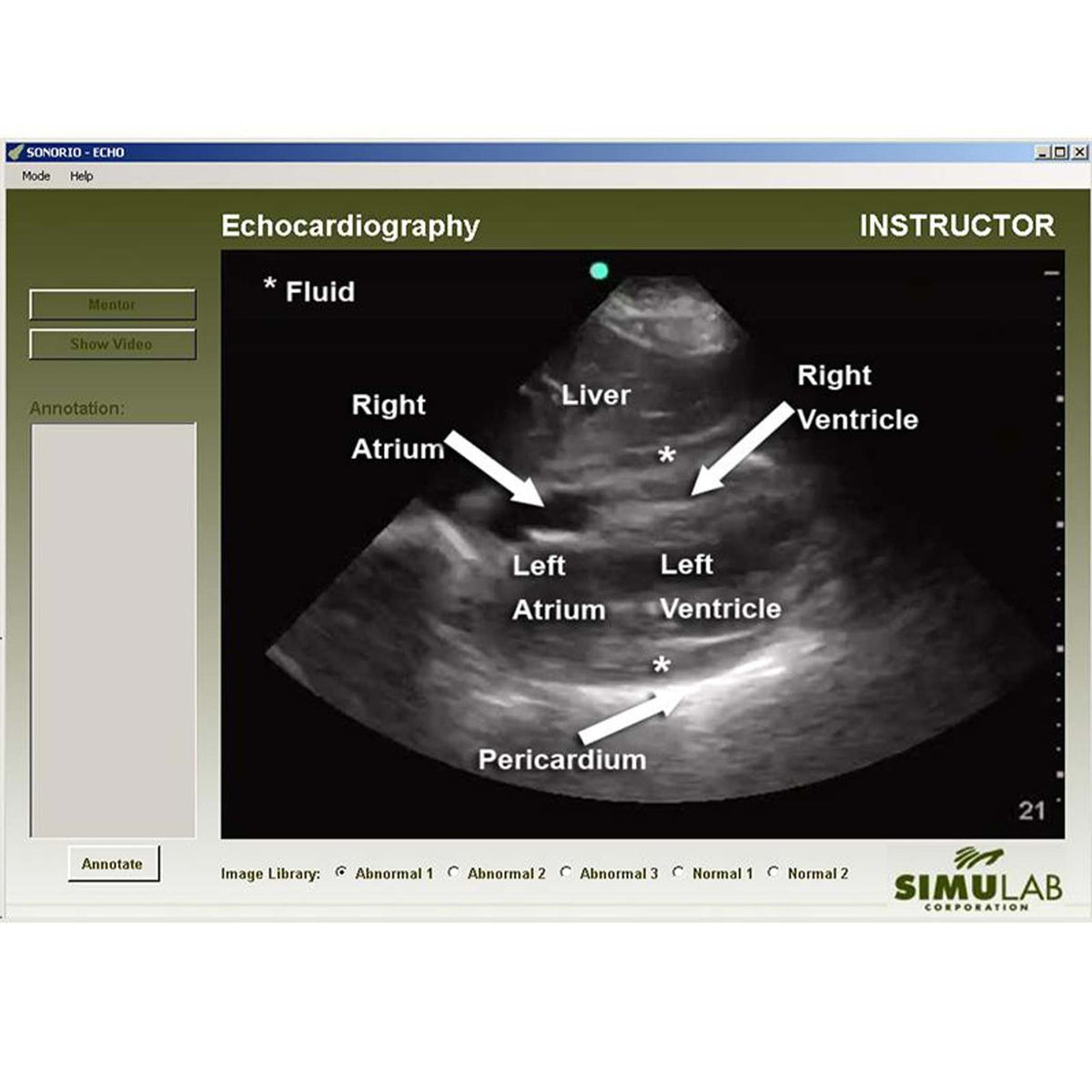 Echo Module for the SonoMan Diagnostic Ultrasound Trainer — Health ...