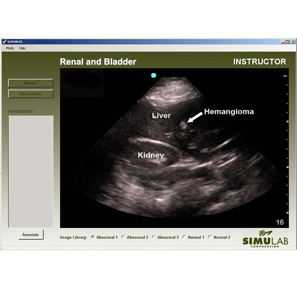 Renal Module for SonoMan System Diagnostic Ultrasound Trainer — Health ...