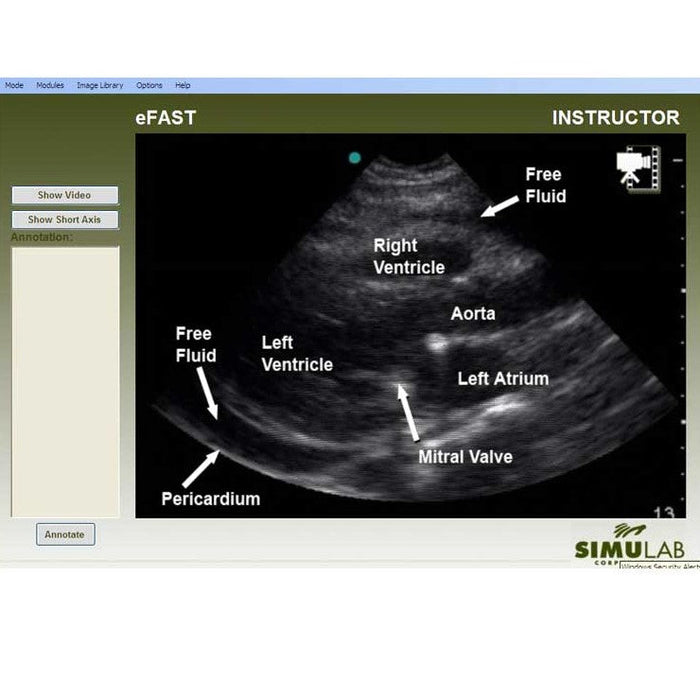 Image 3 - SONOSKIN ULTRASOUND DIAGNOSTIC WEARABLE FOR FAST AND EFAST TRAINING